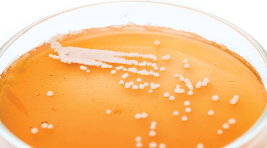 JAtnb21 YEASTSpecialFeature 1140x500