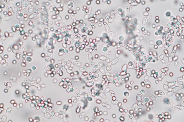 Yeast under microscope